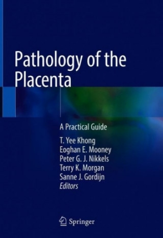 Könyv Pathology of the Placenta T. Yee Khong