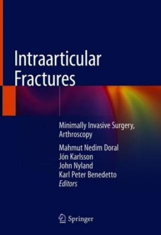 Książka Intraarticular Fractures Mahmut Nedim Doral