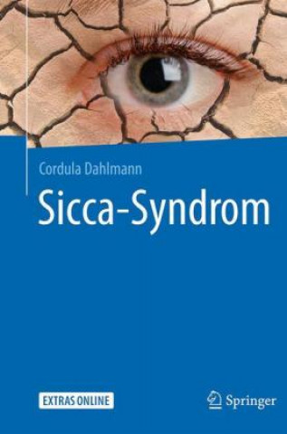 Könyv Sicca-Syndrom Cordula Dahlmann