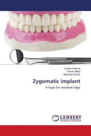 Kniha Zygomatic implant Chetan Krishna