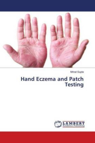 Kniha Hand Eczema and Patch Testing Mrinal Gupta