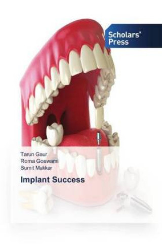 Kniha Implant Success Tarun Gaur