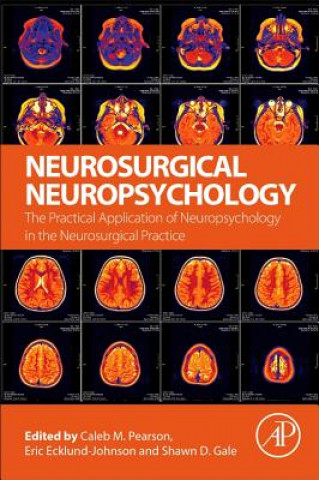 Βιβλίο Neurosurgical Neuropsychology Pearson