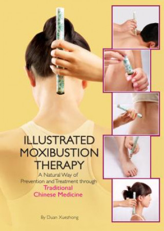 Book Illustrated Moxibustion Therapy Duan Xuexhong