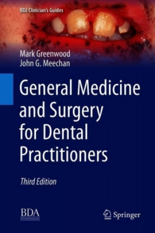 Kniha General Medicine and Surgery for Dental Practitioners Mark Greenwood