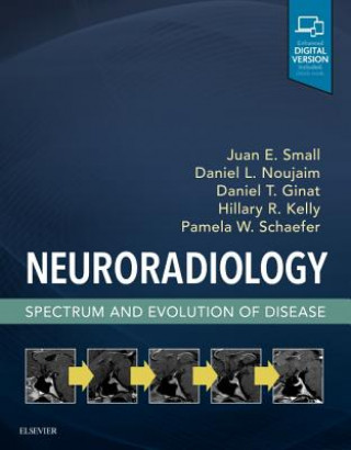 Könyv Neuroradiology: Spectrum and Evolution of Disease Juan Small