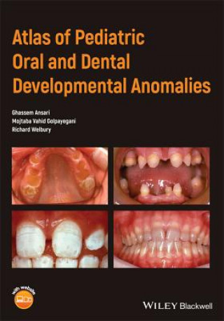Carte Atlas of Pediatric Oral and Dental Developmental Anomalies Ghassem Ansari