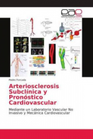 Knjiga Arteriosclerosis Subclínica y Pronóstico Cardiovascular Pedro Forcada