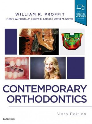 Książka Contemporary Orthodontics William R. Proffit