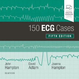 Книга 150 ECG Cases John Hampton