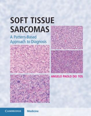 Knjiga Soft Tissue Sarcomas Hardback with Online Resource TOS  ANGELO PAOLO DE