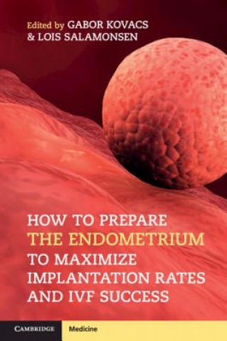 Книга How to Prepare the Endometrium to Maximize Implantation Rates and IVF Success Gabor Kovacs