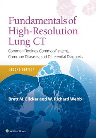 Könyv Fundamentals of High-Resolution Lung CT Elicker