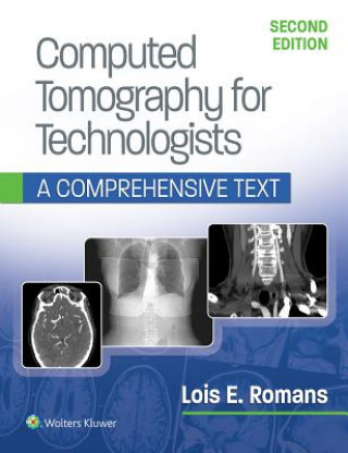 Книга Computed Tomography for Technologists: A Comprehensive Text Lois E. Romans