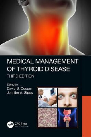 Könyv Medical Management of Thyroid Disease, Third Edition 