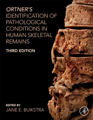 Kniha Ortner's Identification of Pathological Conditions in Human Skeletal Remains Jane Buikstra