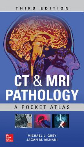 Kniha CT & MRI Pathology: A Pocket Atlas, Third Edition Jagan Mohan Ailinani