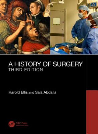 Carte History of Surgery Ellis