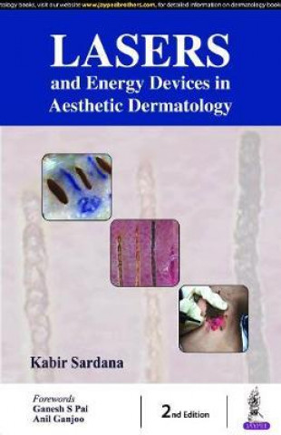 Kniha Lasers & Energy Devices in Aesthetic Dermatology Practice Kabir Sardana