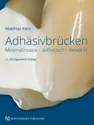 Kniha Adhäsivbrücken Matthias Kern