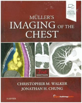 Książka Muller's Imaging of the Chest Christopher Walker