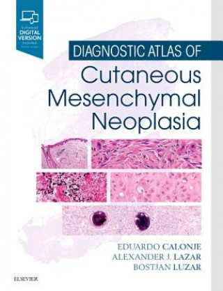 Kniha Diagnostic Atlas of Cutaneous Mesenchymal Neoplasia J. Eduardo Calonje