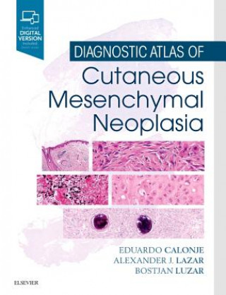 Knjiga Diagnostic Atlas of Cutaneous Mesenchymal Neoplasia J. Eduardo Calonje