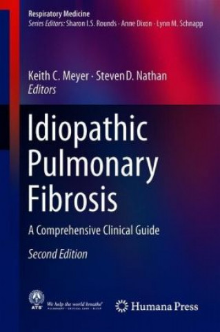 Könyv Idiopathic Pulmonary Fibrosis Keith C. Meyer