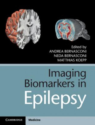 Książka Imaging Biomarkers in Epilepsy Andrea Bernasconi