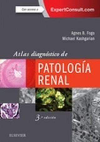 Könyv ATLAS DIAGNÓSTICO DE PATOLOGÍA RENAL AGNES FOGO