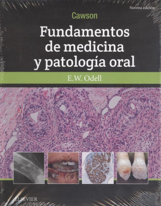 Könyv CAWSON. FUNDAMENTOS DE MEDICINA Y PATOLOGÍA ORAL E.W. ODELL