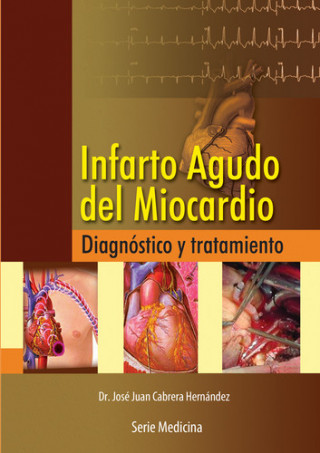 Kniha INFARTO AGUDO DEL MIOCARDIO JOSE JUAN CABRERA HERNANDEZ