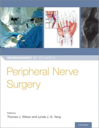 Könyv Peripheral Nerve Surgery Thomas Wilson