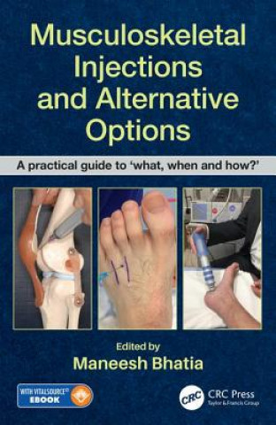 Kniha Musculoskeletal Injections and Alternative Options Maneesh Bhatia