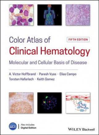 Carte Color Atlas of Clinical Hematology - Molecular and Cellular Basis of Disease VICTOR HOFFBRAND