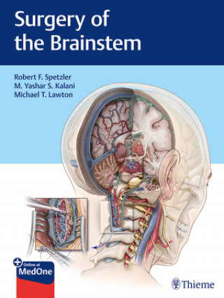 Könyv Surgery of the Brainstem Robert F. Spetzler