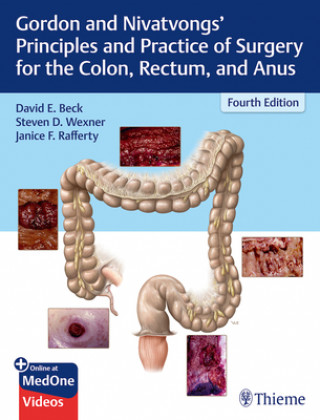 Książka Gordon and Nivatvongs' Principles and Practice of Surgery for the Colon, Rectum, and Anus David E. Beck