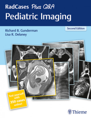 Книга RadCases Plus Q&A Pediatric Imaging Richard B. Gunderman