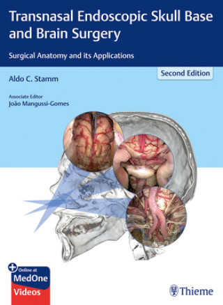 Kniha Transnasal Endoscopic Skull Base and Brain Surgery Aldo C. Stamm