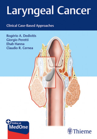 Könyv Laryngeal Cancer Rogerio Dedivitis