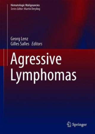Buch Aggressive Lymphomas Georg Lenz