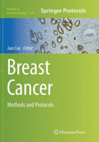 Книга Breast Cancer Jian Cao