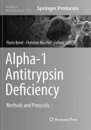 Książka Alpha-1 Antitrypsin Deficiency Florie Borel