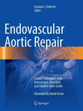 Könyv Endovascular Aortic Repair Gustavo S. Oderich