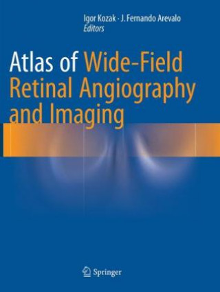 Kniha Atlas of Wide-Field Retinal Angiography and Imaging Igor Kozak
