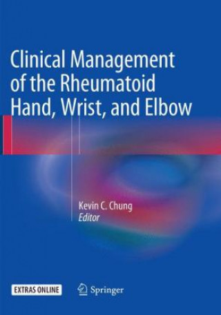 Knjiga Clinical Management of the Rheumatoid Hand, Wrist, and Elbow Kevin C. Chung