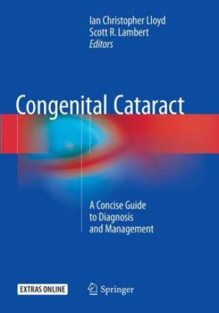 Buch Congenital Cataract Ian Christopher Lloyd