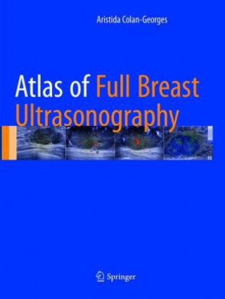 Libro Atlas of Full Breast Ultrasonography Aristida Colan-Georges