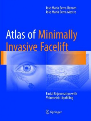 Könyv Atlas of Minimally Invasive Facelift Jose Maria Serra-Renom