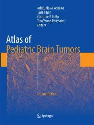 Książka Atlas of Pediatric Brain Tumors Adekunle M. Adesina